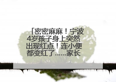 密密麻麻！宁波4岁孩子身上突然出现红点！连小便都变红了……家长：以为只是摔伤